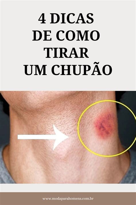 como titar chupao|Como Tirar um Chupão: Dicas Eficazes e Rápidas